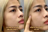 Tuyệt chiêu bôi kem chống nắng “2 lớp” của KOC Quỳnh Như Nguyễn: Tại sao vùng gò má cần được bảo vệ gấp đôi?