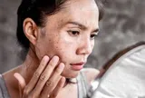Tia UV - “kẻ phá hủy thầm lặng” khiến da già đi chóng mặt nếu không được bảo vệ đúng cách