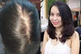 Không cần thuốc đắt tiền, phụ nữ U40 vẫn có thể sở hữu mái tóc dày khỏe nhờ 5 thay đổi trong sinh hoạt