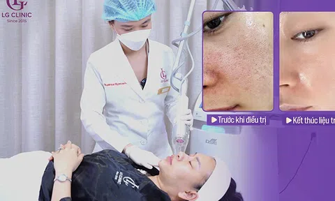 Giải mã sức hút Deep FX Laser: Công nghệ thu nhỏ lỗ chân lông thế hệ mới đang “gây bão” tại LG Clinic