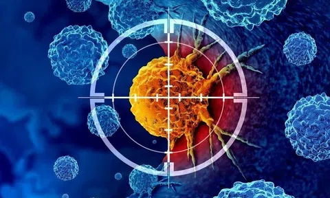 Bệnh nhân ung thư được phát hiện sớm nhờ thiết bị này