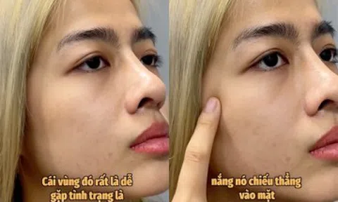 Tuyệt chiêu bôi kem chống nắng “2 lớp” của KOC Quỳnh Như Nguyễn: Tại sao vùng gò má cần được bảo vệ gấp đôi?