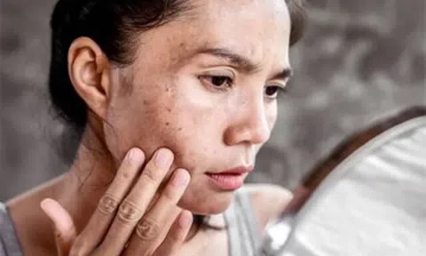 Tia UV - “kẻ phá hủy thầm lặng” khiến da già đi chóng mặt nếu không được bảo vệ đúng cách