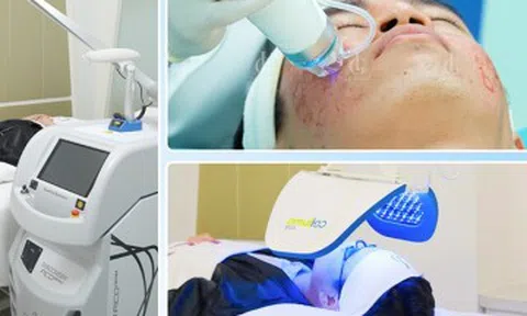 Giải mã 5 nguyên nhân giúp Triple Treatment trở thành công nghệ điều trị sẹo rỗ hàng đầu Việt Nam