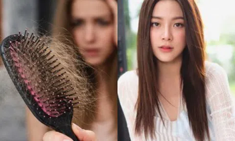 5 thói quen "lười mà đúng" giúp mái tóc yếu, dễ rụng trở nên khỏe hơn