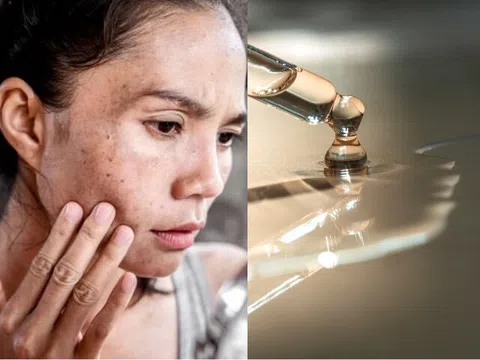 Những thành phần dưỡng da gặp trời nắng liền "phản chủ", càng dùng càng làm da bị kích ứng nặng